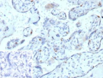 Anti-Cyclin E1 / CCNE1, clone r13A3