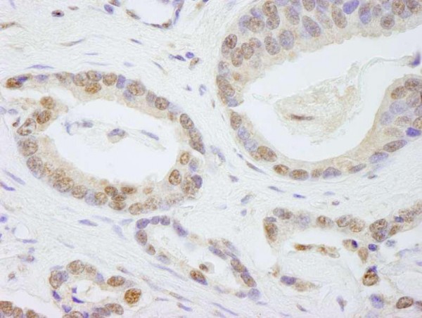 Anti-TAF6 (IHC)