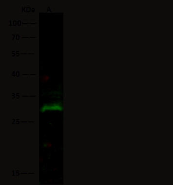 Anti-PRTFDC1 Monoclonal Antibody