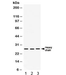 Anti-Cathepsin D