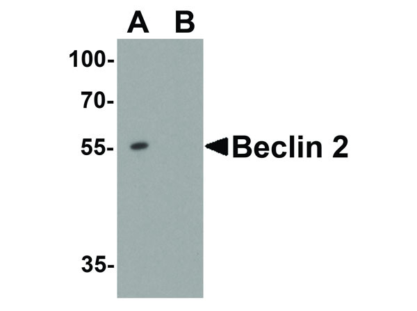 Anti-Beclin 2