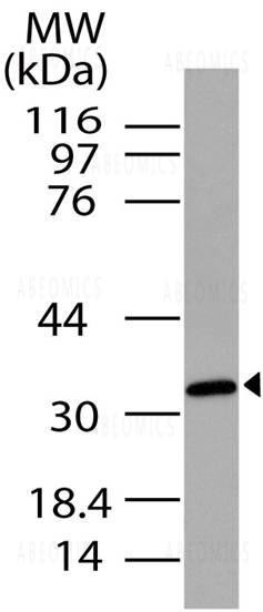 Anti-C5L2/GPCR77