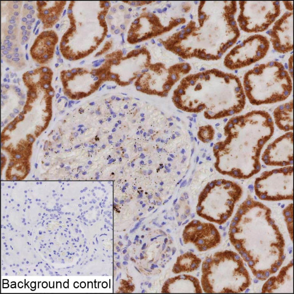 Anti-CA5B