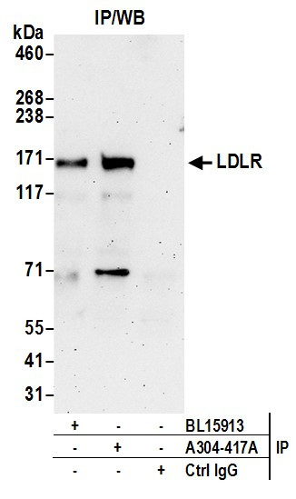 Anti-LDLR