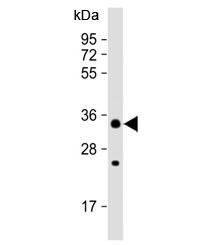 Anti-STUB1