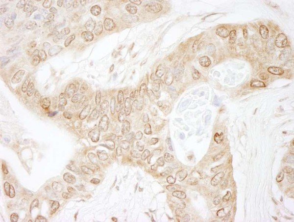 Anti-IKK-alpha (IHC)