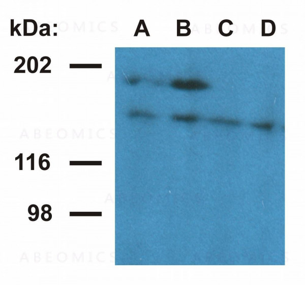 Anti-Ubinuclein 1 Monoclonal Antibody (Clone:UBN1-02)