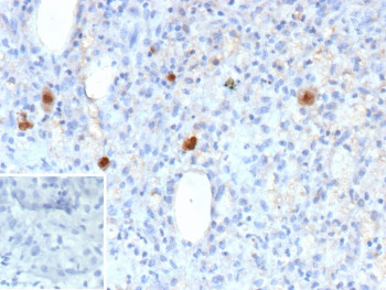 Anti-Cytomegalovirus / HCMV pp65, clone r6