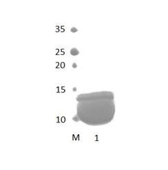 PDLIM3 PDZ Domain