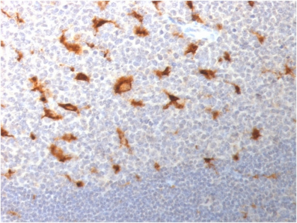 Anti-CD68 (Macrophage Marker), clone LAMP4/1830