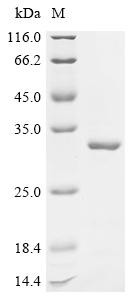 Stathmin-2 (Stmn2), mouse, recombinant
