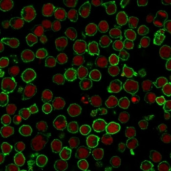 Anti-CD45RO (T-cell marker), clone 190-2F2.5