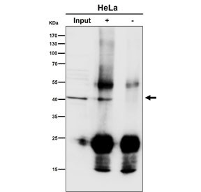 Anti-ACAT1 / Acetyl-CoA acetyltransferase, clone 29A55