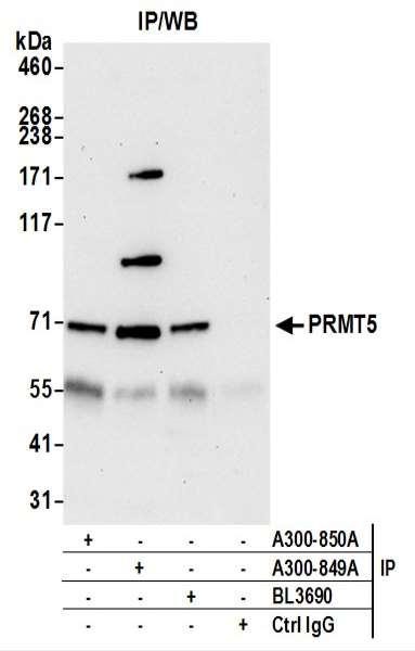 Anti-PRMT5