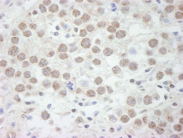 Anti-DDX17 (IHC)
