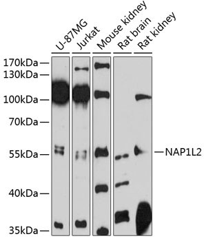 Anti-NAP1L2