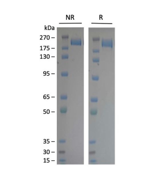 Spike Trimer (S1+S2) (XBB.1.5, Omicron Variant), His-Tag (SARS-CoV-2) Recombinant