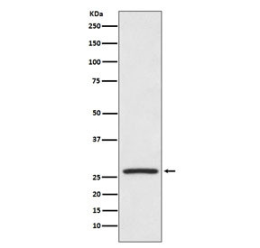 Anti-HSP27 / HSPB1, clone HII-8