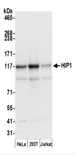 Anti-HIP1/Huntingtin-interacting Protein 1