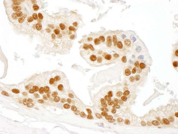 Anti-RAD23B (IHC)