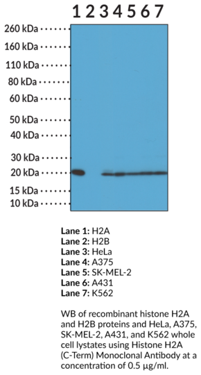 Anti-Histone H2A (C-Term) Monoclonal Antibody (Clone RM225)