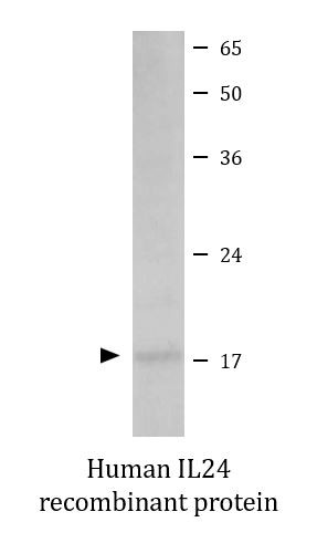 Human IL24 recombinant protein (Active)