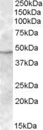 Anti-TMPRSS4, Internal