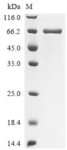 IL-12 receptor beta component (IL12RB1), partial, human, recombinant