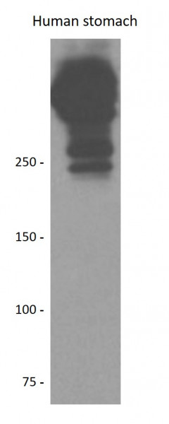 Anti-Mucin 5AC