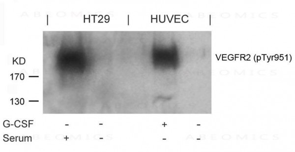 Anti-phospho-VEGFR2 (Tyr951)