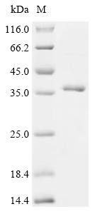 C-C motif chemokine 20 (CCL20), partial, recombinant human