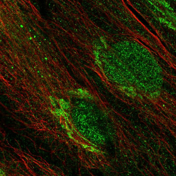 Anti-CDK15