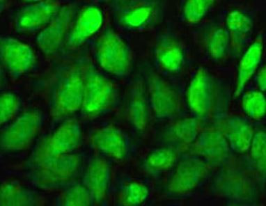 Anti-PCBP2 / hnRNP E2
