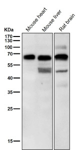 Anti-phospho-p70 S6 Kinase beta (Ser371), clone 32R04