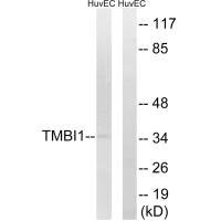 Anti-TMBIM1