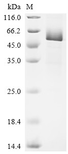 Interleukin-1 receptor-like 2 (Il1rl2), partial, mouse, recombinant