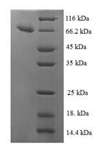 Isocitrate dehydrogenase [NAD] subunit beta, mitochondrial (IDH3B), human, recombinant