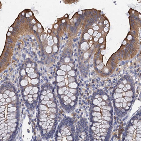 Anti-ACSM3