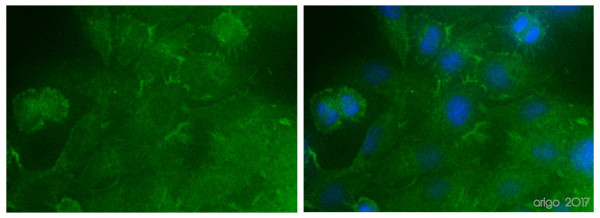 Anti-Actin, clone BA3R