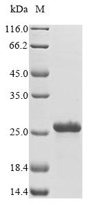 40S ribosomal protein S13 (RPS13), Ciona intestinalis, recombinant