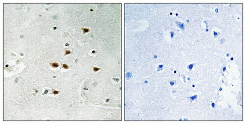 Anti-Phospho-ITCH (Tyr420)