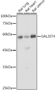 Anti-GAL3ST4