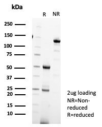 Anti-IL18R1 / Interleukin 18 receptor alpha, clone IL18R1/7593