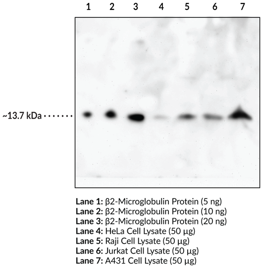 Anti-beta2-Microglobulin