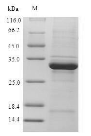 Ubiquitin-conjugating enzyme E2 D3 (UBE2D3), human, recombinant