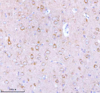 Anti-STXBP6 / Syntaxin-binding protein 6