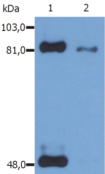 Anti-phospho-STAT1 (Ser727), clone PSM1