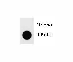 Anti-phospho-Dnmt1 (Ser1105)