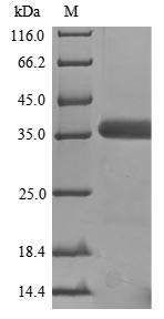 Guanine nucleotide-binding protein G (o) subunit alpha (Gnao1), mouse, recombinant