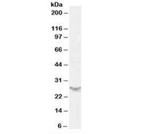 Anti-PSME2